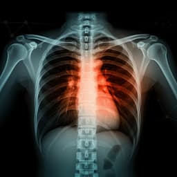 COVID-19 Prognosis from Chest X-ray Images by using Deep Learning Approaches: A Next Generation Diagnostic Tool