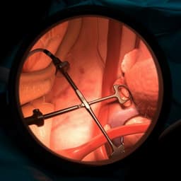 Development, deployment and scaling of operating room-ready artificial intelligence for real-time surgical decision support