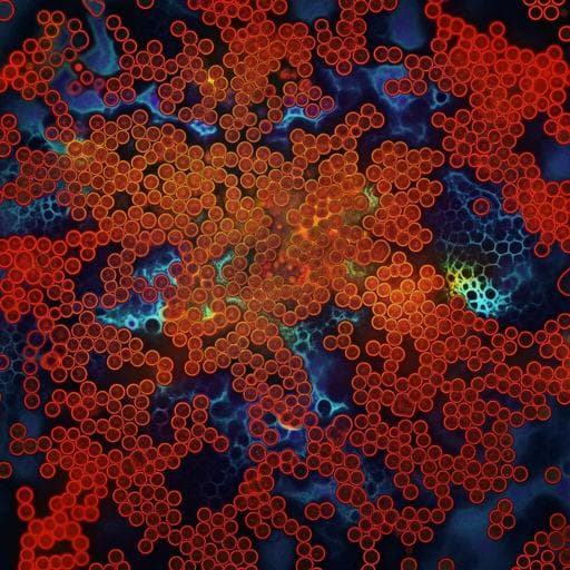 Intersecting social and environmental determinants of multidrug-resistant urinary tract infections in East Africa beyond antibiotic use