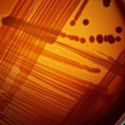 The need for high-resolution gut microbiome characterization to design efficient strategies for sustainable aquaculture production